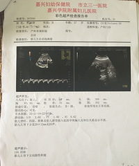 "孕36周B超显示胎儿左肾下方局限性积液"
