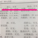 ��ά��ʾ̥��ƫ��