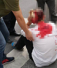 �������ˣ����ӵ�������֮Զ ����ͷ��Ѫ����