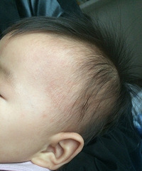 ��ظ���������ҽ������ʪ��������ʲô