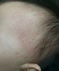 ��ظ���������ҽ������ʪ��������ʲô