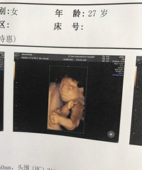 4ά���� �������������ͷ��ܵ