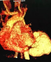 ȫ����������Ӥ�Դ�������ը����