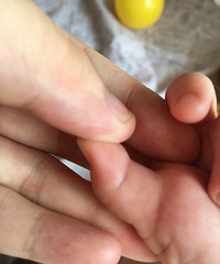 �߸��´�Ӥ�����ִ�Ĵָ�첻ֱ  ���ĸ����ң�