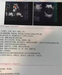 ���������  ������2�����ݱ�֤���б���