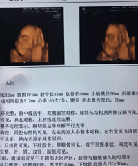 ɹɹ�����ʳ�¯����ά��Ƭ ��