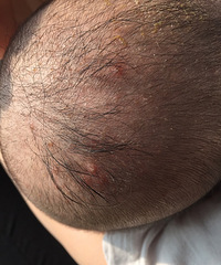 ����һֱ��ñ�� ͷ�����춻��  ��������ͷ��