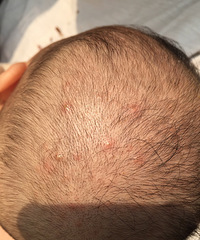 ����һֱ��ñ�� ͷ�����춻��  ��������ͷ��