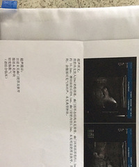 [����]������������  ����������û����