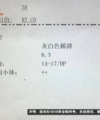 "难言之隐去“强生”,前列腺还是肾?"
