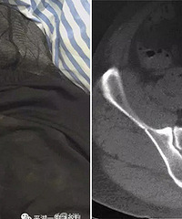 ����С��ˤ�� 30cm�ֽ�������