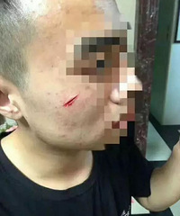 ��Ѫ�Ļ��񣺴����÷����ţ������ż������� ���ǽ��׻�������