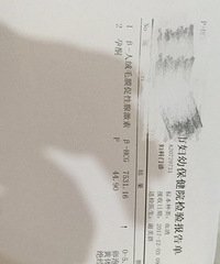 ��ͼ�������ֵ��Ҫ��һ�������ͪƬ��