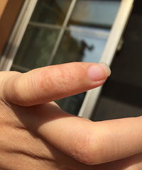 ι�����������ָ Ƥ���������Ǹ���ȱˮ��