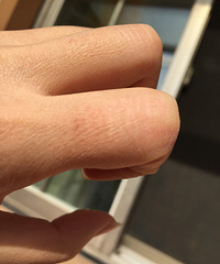 ι�����������ָ Ƥ���������Ǹ���ȱˮ��