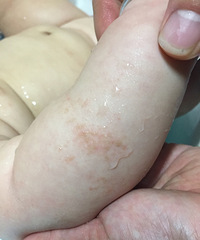 Ӥ���ֱ����϶��п���ȥ��޺һ���Ķ��� ��Ƥ��̫�����ԭ����