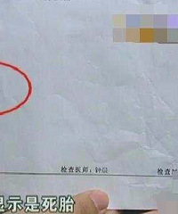 "女子预产前三天胎儿突然死亡,医院:让她来吸氧她嫌路程远"