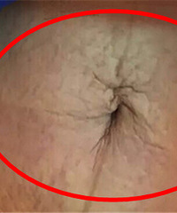 ���꺢�Ӷ�Ƥ���ɿ�� �ѿ���Ҫ����