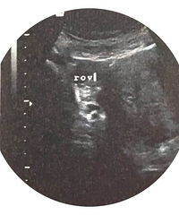 ����15�ܶ��ĺܿ� �����ж���������ͷ�� ������ج��..