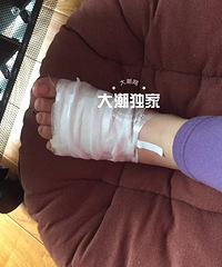 "吓人!海宁一女子泡脚出事了!曾有人因此截肢!这些人千万注意.