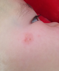 �������ϵ�����һС��10�·ݾ����� ������ҪȥҽԺ������