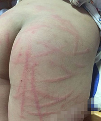 �ܺ��Ӵ�28¥����15��ơ��ƿ ƨ�ɱ��ҳ��򿪻���