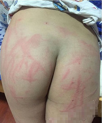 �ܺ��Ӵ�28¥����15��ơ��ƿ ƨ�ɱ��ҳ��򿪻���