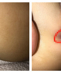 �������ܳ��˺��� ��Ƥ�½���