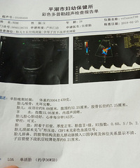 "【悦程妇产杯.孕妈日记】+二胎妈妈的怀孕历程"