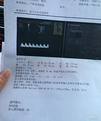 "30w+5的时候做出来胎盘成熟度2级正常吗"