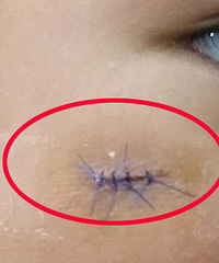 ����������ߣ��������׶�԰ˤ�� ��������4��