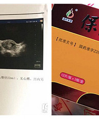 ����һ���ڱ�̥ҩ ��û��ʲô��