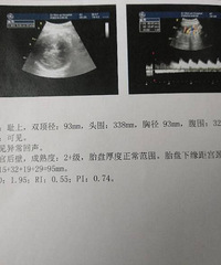 ��������ë�����Ǹ�С����