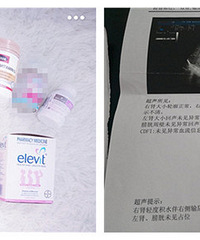 ��5��������ˮ ҪסԺ��������