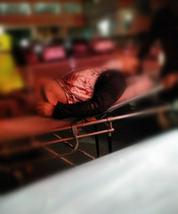 �𾪣�����������ҹ������Ѫ�赹��·�� ��˵�Ǳ�...Ĩ���ӣ�