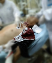 �𾪣�����������ҹ������Ѫ�赹��·�� ��˵�Ǳ�...Ĩ���ӣ�