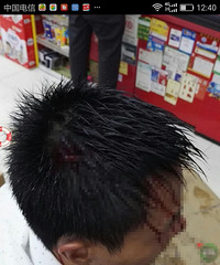 �ڳ������� Ī������˴��ͷ��Ѫ����