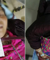 ��ƿ�����б��ε� ɲ����ֱ������