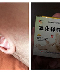 �޶�����ŧ ��ҩ���Ƿ��м���