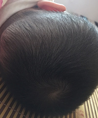 [����]����������͹�� ҽ��ȴ˵�ǹ�ͷ