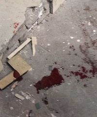 ���ϴ�̲Ѫ��������һ����̤��ʯ���ߴ�7¥׹�䣡