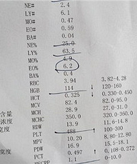 2个月宝宝咳嗽 怎么判断是不是肺炎