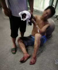 Ѫ�ȣ�����һ���ӱ����翳��Ѫ�� ��ת��Ժ��