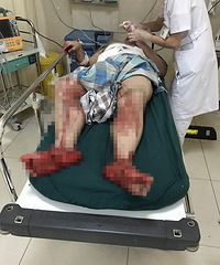 ̫�ݣ�������20�����Ӷ����ϱ�ͬ��ͱ��һ�� �ŵ׶���Ѫ����