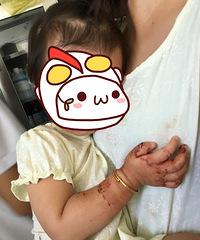 ���һ���Ů������������ȫ��Ѫ ���˼��˺ü���ҽԺ������