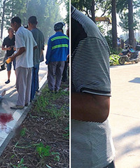 ���β��ҳ��������ӱ�ײ ͷ�´�ƬѪ��