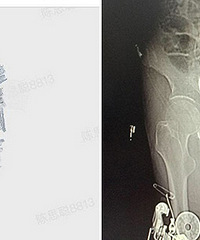 ���ض��� ����һ����������...