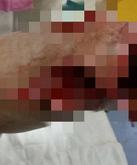 血腥!嘉兴一男子手被卷入机器