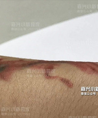 ����һ��Ů��ĳ����λ����һ���� ���ȴ���ò�ȥ��ҽ��