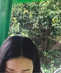 有钱的烦恼!用了海蓝之谜面霜一个多月 额头疯狂长痘痘